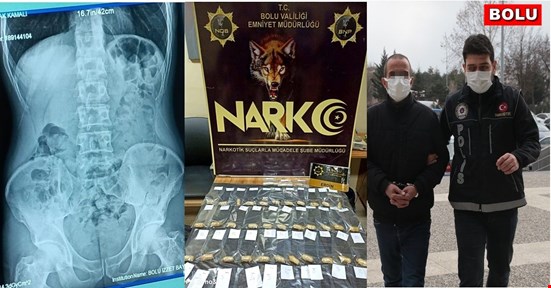 Midesinden çıkanlar şaşırttı