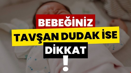 BEBEĞİNİZ TAVŞAN DUDAK İSE DİKKAT !