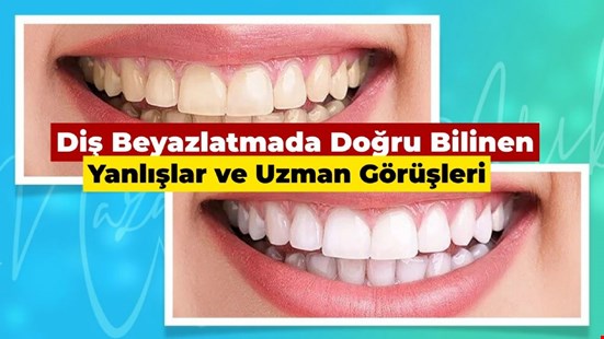 Diş Beyazlatmada Doğru Bilinen Yanlışlar ve Uzman Görüşleri