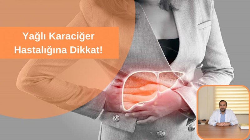 Yağlı Karaciğer Hastalığına Dikkat!
